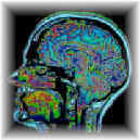 Brain1.jpg (4489 bytes)